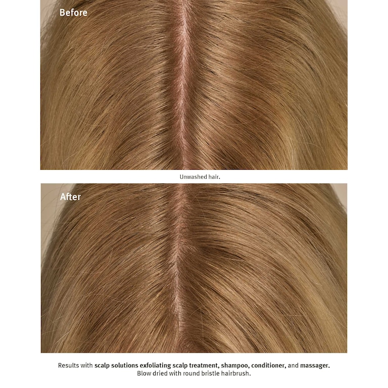 scalp solutions spazzola massaggiante cuoio capelluto, Model