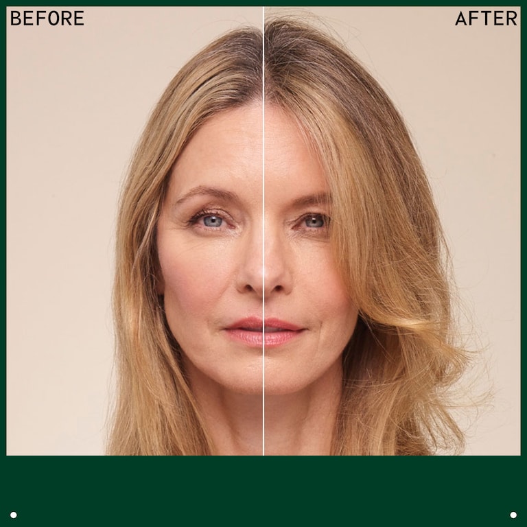 invati ultra advanced™ champú exfoliante - ligero