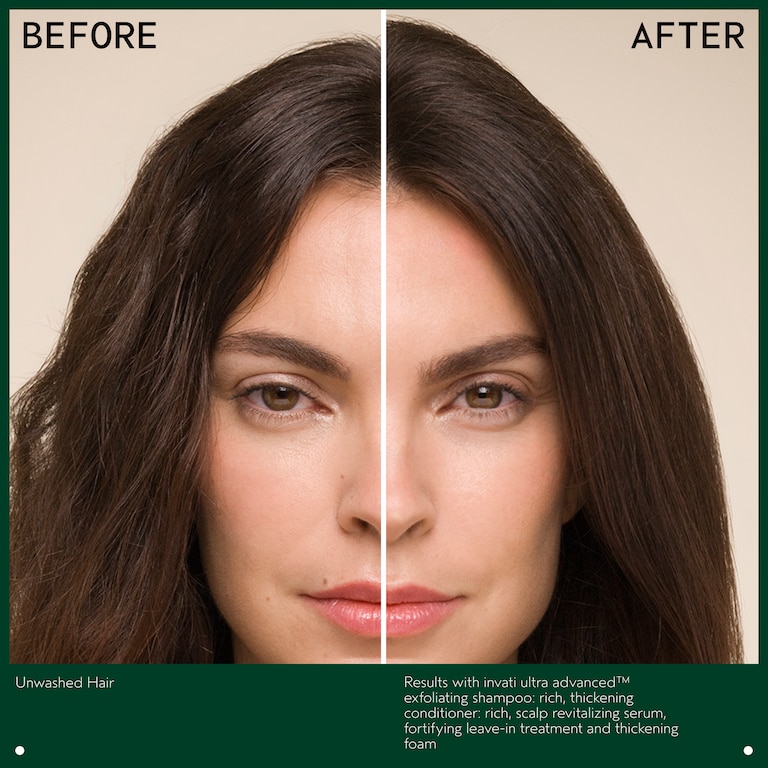 invati ultra advanced™ revitalizing scalp serum