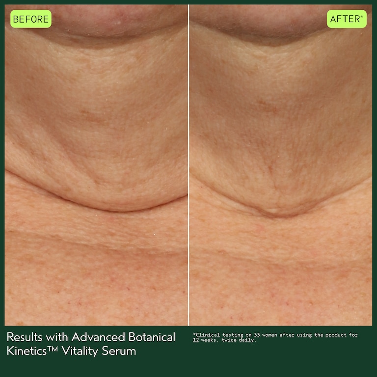 Vitality Serum, 30.0 ml, Model