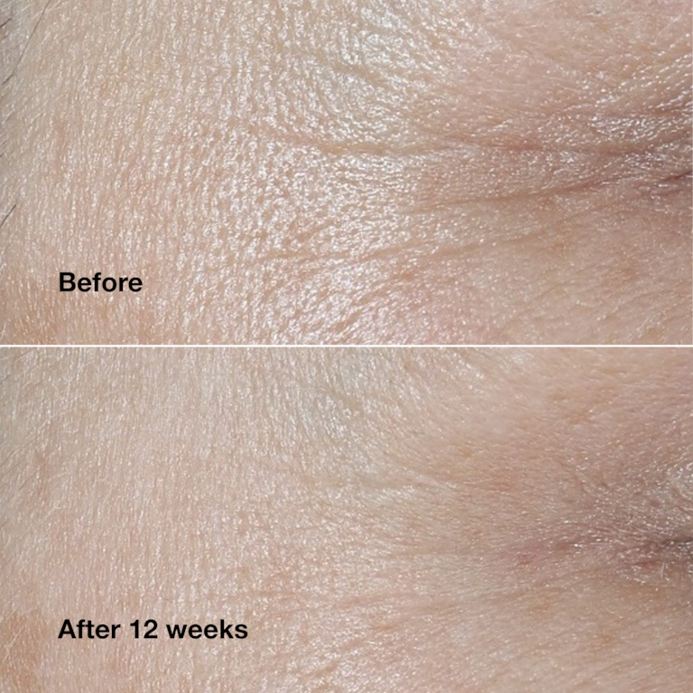 Clinique Smart Clinical Repair™ Wrinkle Correcting Cream