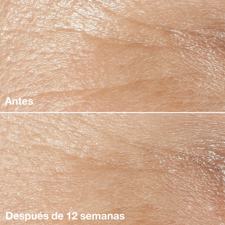 Clinique Smart Clinical Repair™ Crema Rica de Corrección Antiarrugas, Model, Light Skin Tone