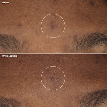 Even Better Clinical™ Brightening Moisturizer