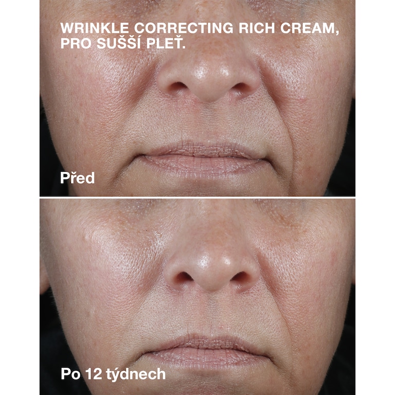 Clinique Smart Clinical Repair&trade; Wrinkle Correcting Rich Cream, Model, Light Skin Tone