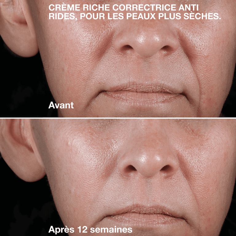 Clinique Smart Clinical Repair&trade; Crème Riche Correctrice Anti-Rides, Model, Light Skin Tone