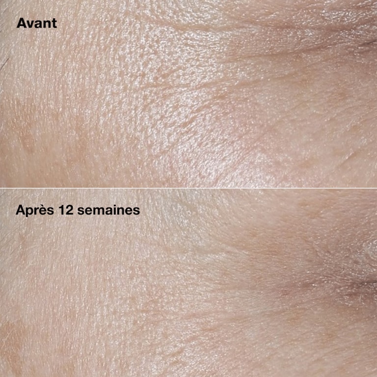 Clinique Smart Clinical Repair™ Crème Correctrice Anti-rides SPF30