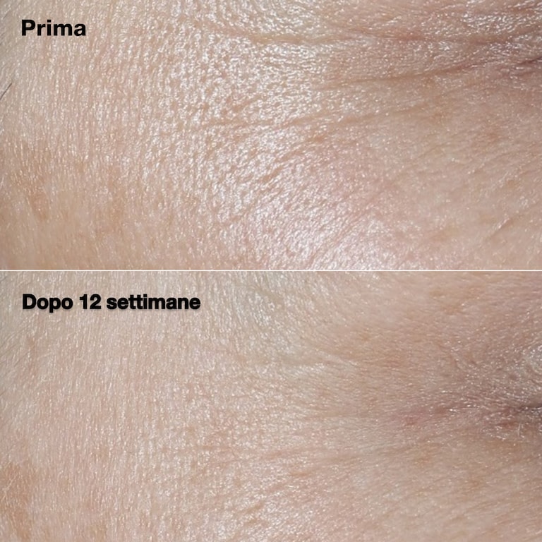 Clinique Smart Clinical Repair™ SPF30 Wrinkle Correcting Cream