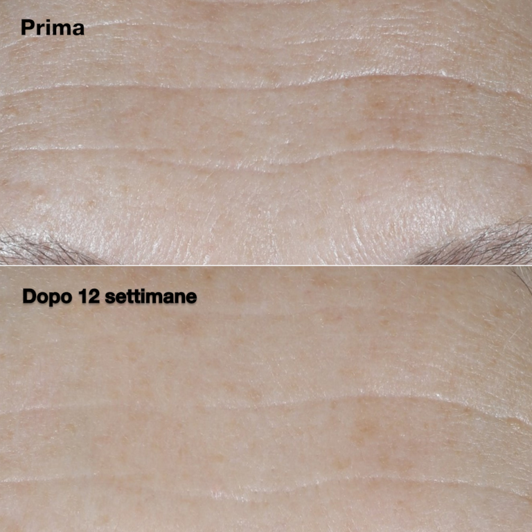Clinique Smart Clinical Repair™ SPF30 Wrinkle Correcting Cream