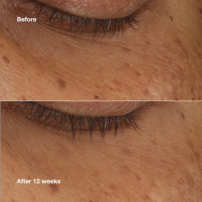 All About Eyes™ Brightening Serum Concentrate