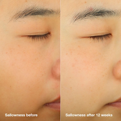 Even Better Clinical™ Dark Spot Clearing Serum