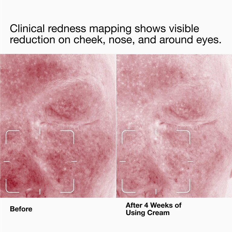 Clinique Daily Calm™ Soothing Repair Cream