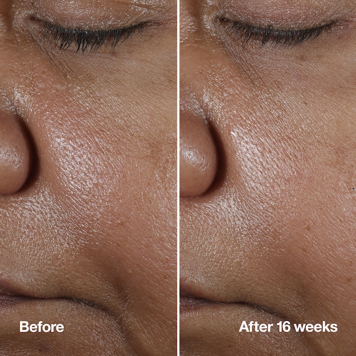 Clinique Smart Clinical Repair™ Wrinkle Correcting Serum