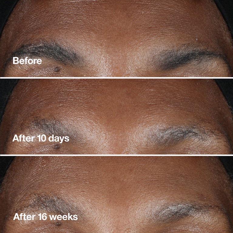 Clinique Smart Clinical Repair™ Wrinkle Correcting Serum