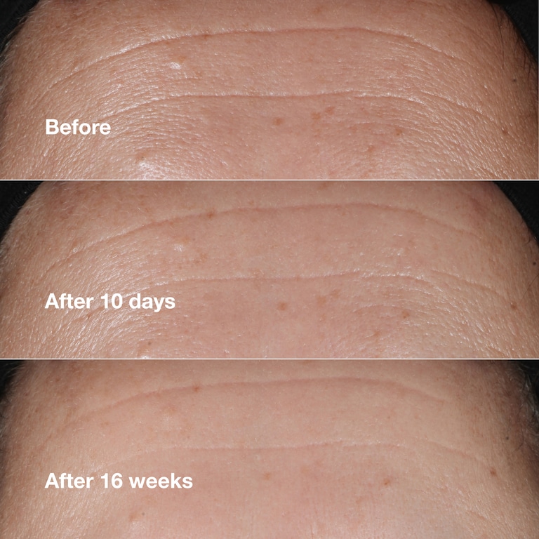 Clinique Smart Clinical Repair™ Wrinkle Correcting Serum
