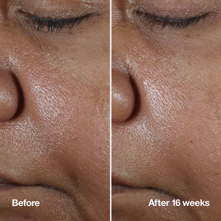 Clinique Smart Clinical Repair™ Wrinkle Correcting Serum