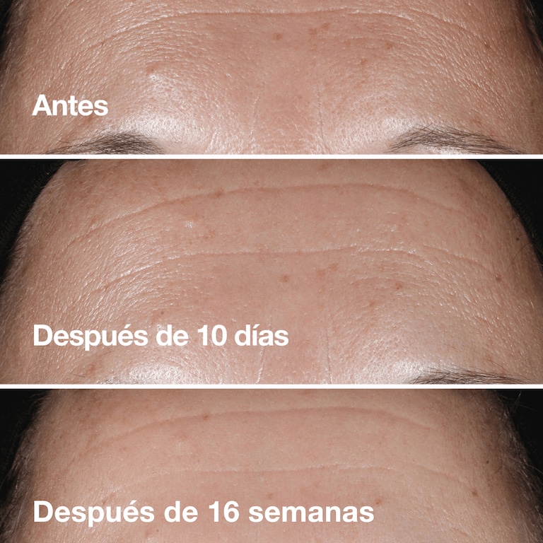 Clinique Smart Clinical Repair&trade; Sérum de Corrección Antiarrugas, Model, Light Skin Tone