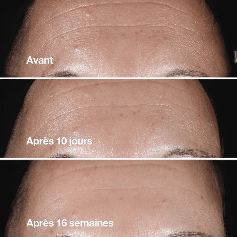 Clinique Smart Clinical Repair&trade; Sérum Correcteur Anti-Rides, Model, Light Skin Tone