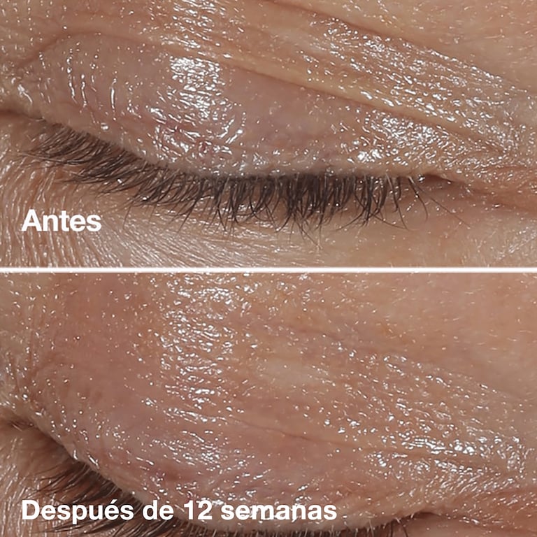 Clinique Smart Clinical Repair&trade; Crema de Contorno de Ojos de Corrección Antiarrugas, Model, Light Skin Tone