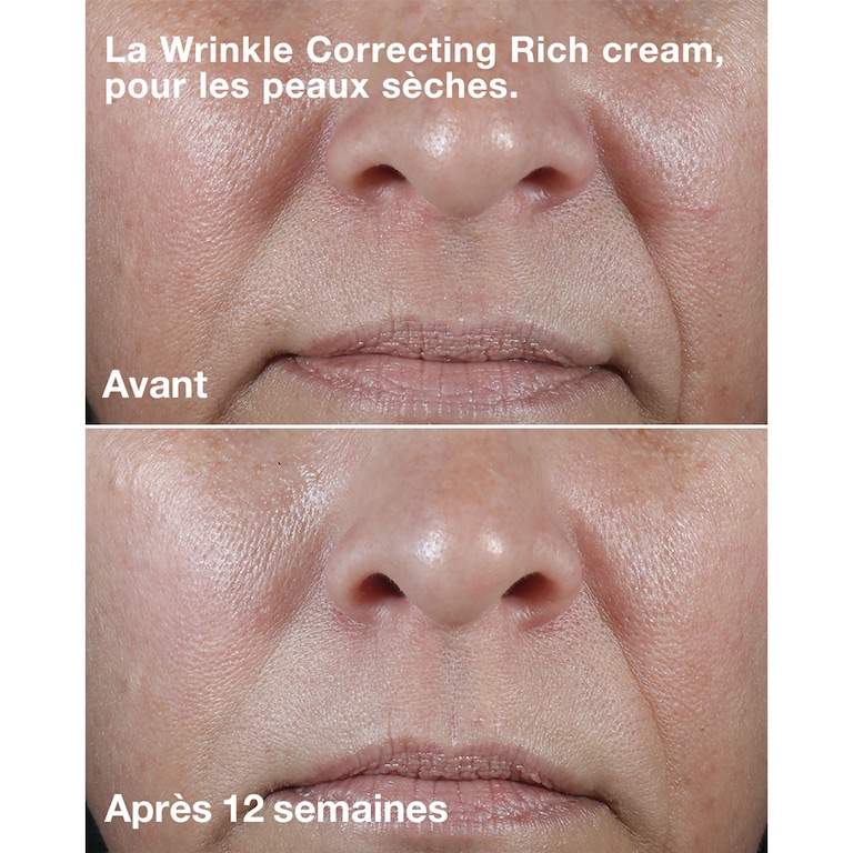 Clinique Smart Clinical Repair&trade; Wrinkle Correcting Cream, 50ml, Model, Light Skin Tone