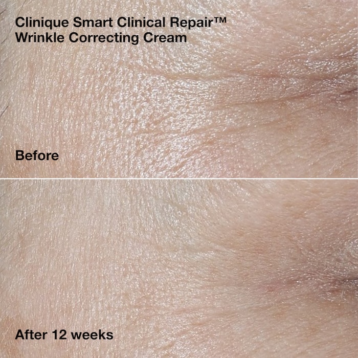 Wrinkle-Correcting Routine, Model, medium