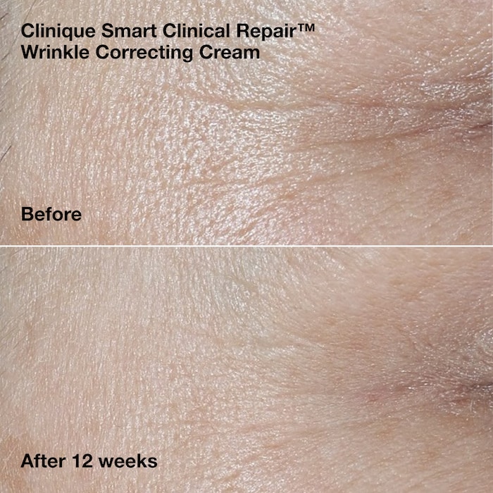 De-Aging Routine, Model, medium