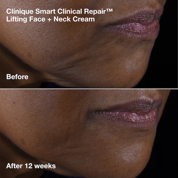 Face + Neck Lift Routine, Model, deep