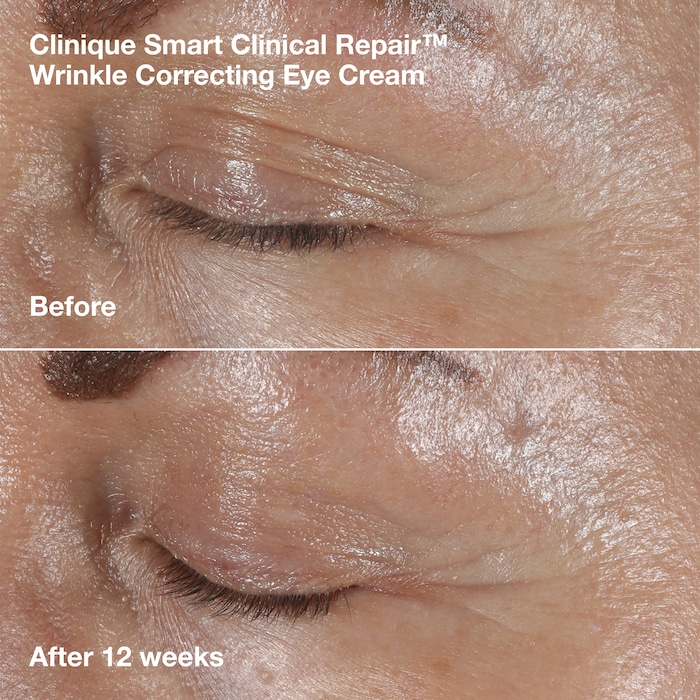 Face + Neck Lift Routine, Model, medium