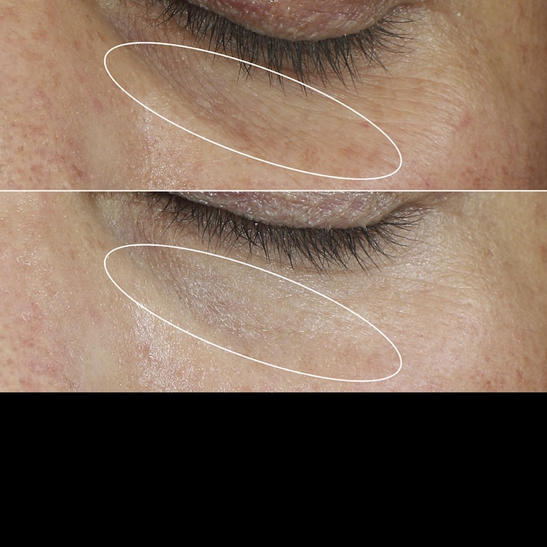 Re-Nutriv Ultimate Diamond Crema para el contorno de los ojos rejuvenecedora