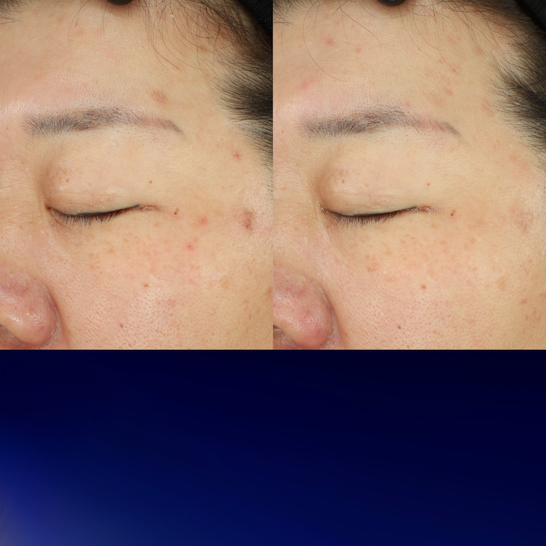 Advanced Night Repair Recovery Treatment Essence/Treatment Lotion